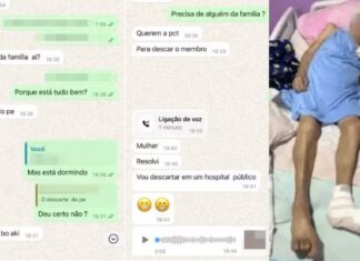 Idosa tem pé amputado em casa, sem anestesia e com bisturi cego por enfermeira