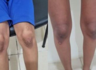 Mãe e madrasta são presas por tortura contra crianças de 13 e 7 anos