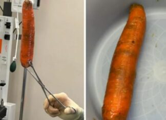 Homem vai parar na emergência para retirar ‘cenourão’ do ânus