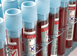OMS alerta sobre risco de desabastecimento de tratamentos contra HIV em oito países