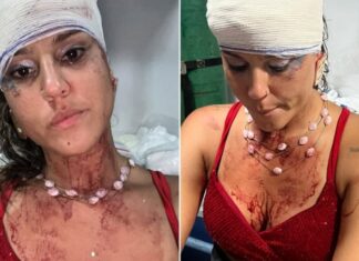 “Apanhei de policiais”: Mulher denuncia agressão durante bloco de Carnaval