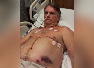 Internado na UTI, Bolsonaro mostra imagem do corte cirúrgico