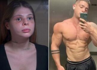 Médica que teve rosto desfigurado por namorado revela: ‘Quando acordei ele ainda estava me batendo’