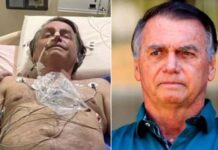 Ex-presidente Jair Bolsonaro é diagnosticado com câncer de pele