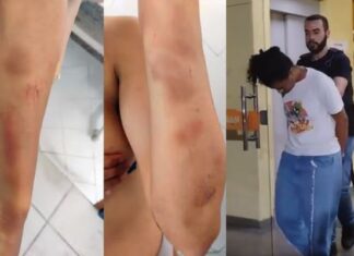 Mulher é presa por atear fogo na ex-companheira e manter a vítima em cárcere privado