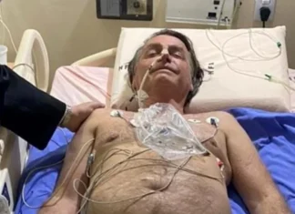 Laudo da Polícia Federal indica que Bolsonaro necessita de cirurgia eletiva para hérnia