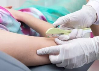 Ministério da Saúde libera implante contraceptivo em jovens sem autorização dos pais