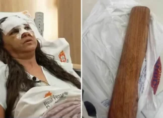 Mulher com câncer de fígado é espancada a pauladas pelo próprio marido