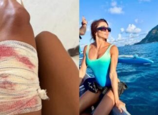 Mulher é atacada por tubarão durante mergulho em Fernando de Noronha