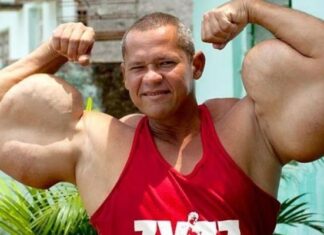 Morre aos 55 anos, Arlindo Anomalia, conhecido como o Popeye Brasileiro