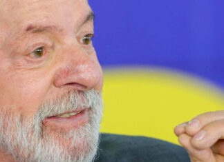 Lula tem evolução satisfatória após cirurgia de catarata no olho esquerdo