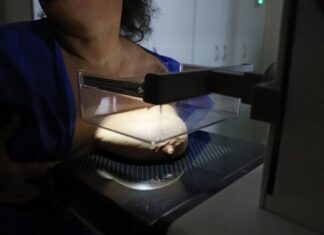 Mamografia em dia 92% das brasileiras entre 50 e 69 anos fizeram o exame