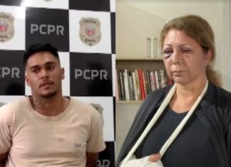 Funcionária de hotel é atacada e fica ferida após recusar beijo de hóspede
