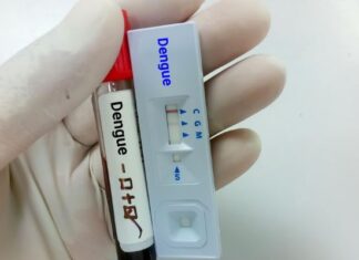 SUS passa a oferecer teste rápido de dengue