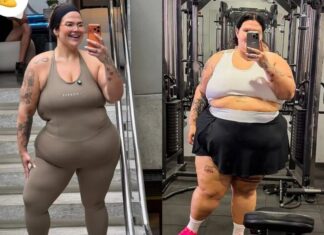 Thais Carla marca um ano de bariátrica e relata perda de 100 kg