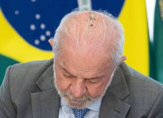 Lula realiza novas sessões de radioterapia no couro cabeludo durante tratamento contra câncer de pele