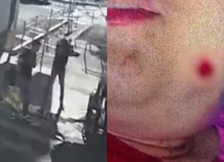 Homem atira em jovem autista após questionar sorriso da vítima