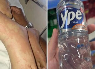 Caso de possível contaminação por detergente Ypê é descartado após exames médicos