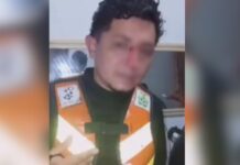 Mototaxista sofre corte profundo no rosto após ser atingido por linha de papagaio no AM