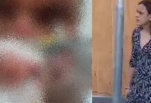 Idoso relatou ‘ataque satânico’ após ser espancado por travesti e perder os dois olhos em Manaus